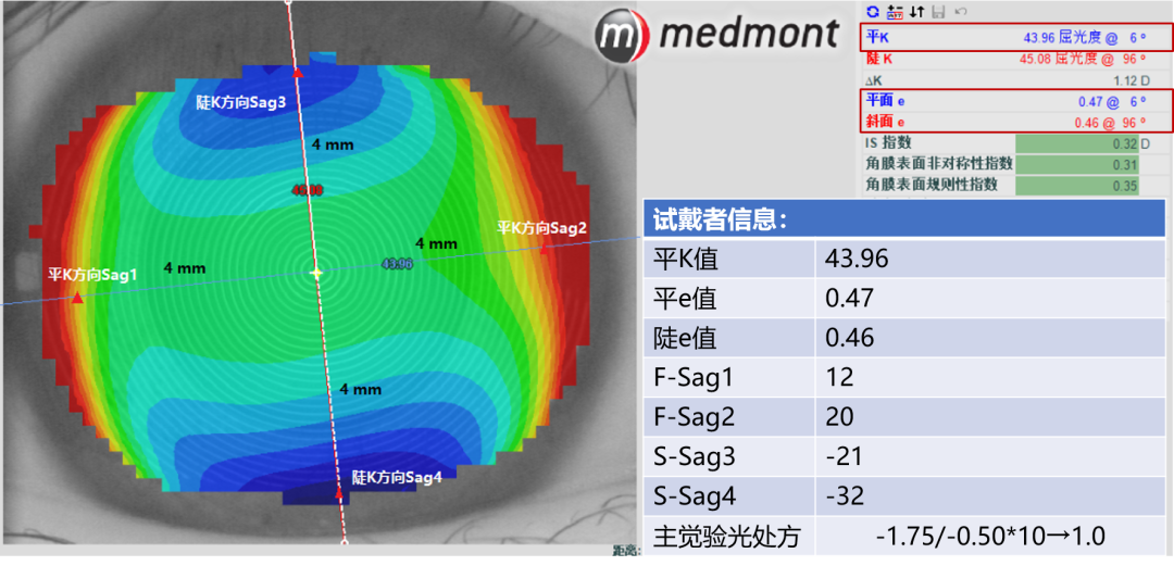 电脑验光器怎么用普诺瞳 ｜ 圆盘计算器_https://www.jmylbn.com_新闻资讯_第2张