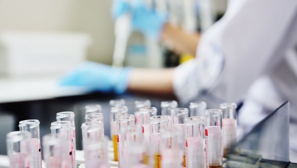 QU昆士兰大学应邀参与新型冠状病毒疫苗研发 全球防控疫情