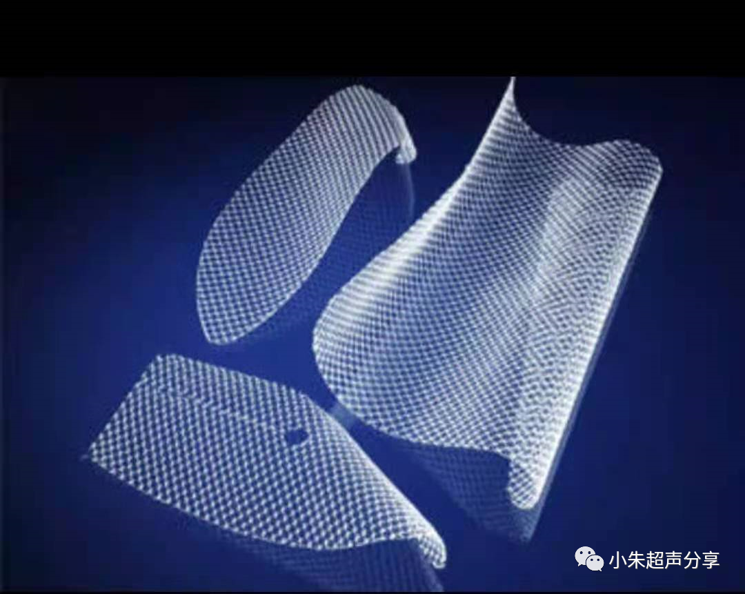 什么是疝气补片原来 “补片” 是这样子的_https://www.jmylbn.com_新闻资讯_第15张