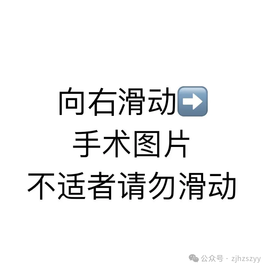 止血纱布怎么用止血纱布用了三排、整个器官青紫……这个位置“动”一下，差点命都没了_https://www.jmylbn.com_新闻资讯_第2张