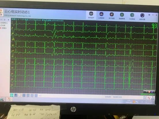 siui彩超怎么用【健康科普】心电图与心脏彩超，该做哪一个呢？_https://www.jmylbn.com_新闻资讯_第5张