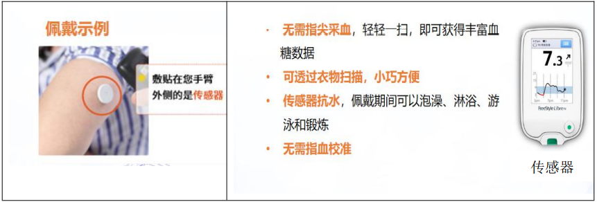 全科诊疗仪是什么我中心全科开展瞬感动态血糖监测技术---告别疼痛，不抽血、不扎针，随时随地监测血糖！_https://www.jmylbn.com_新闻资讯_第2张