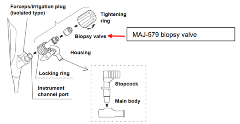fda 怎么查器械医疗器械警戒快讯 2025年第2期（总第216期）_https://www.jmylbn.com_新闻资讯_第2张
