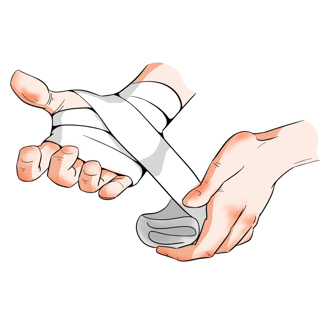 传统外伤敷料有哪些日常使用伤口敷料，你选对了吗？_https://www.jmylbn.com_新闻资讯_第9张