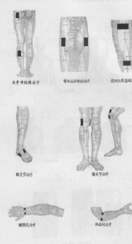 中频为什么能镇痛您会使用电脑中频电治疗仪吗？_https://www.jmylbn.com_新闻资讯_第2张