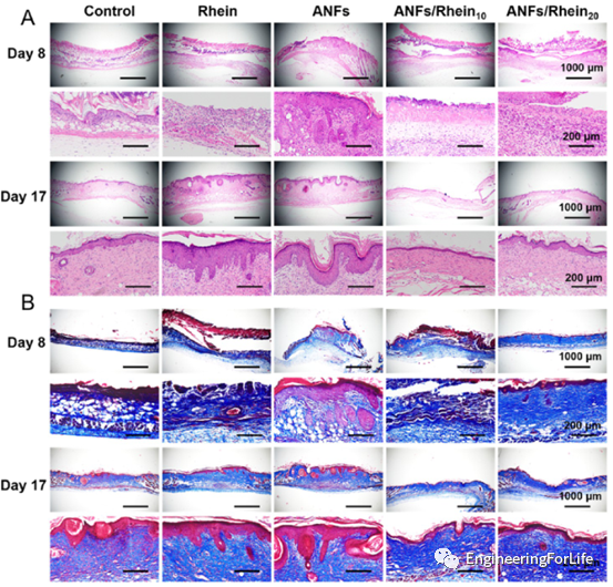 烧伤敷料怎么用图解《ACS AMI》：全能烧伤创面敷料！显著抗菌和抗炎！_https://www.jmylbn.com_新闻资讯_第8张