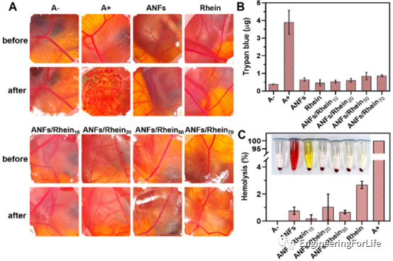 烧伤敷料怎么用图解《ACS AMI》：全能烧伤创面敷料！显著抗菌和抗炎！_https://www.jmylbn.com_新闻资讯_第4张