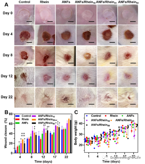 烧伤敷料怎么用图解《ACS AMI》：全能烧伤创面敷料！显著抗菌和抗炎！_https://www.jmylbn.com_新闻资讯_第7张