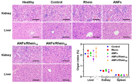 烧伤敷料怎么用图解《ACS AMI》：全能烧伤创面敷料！显著抗菌和抗炎！_https://www.jmylbn.com_新闻资讯_第10张