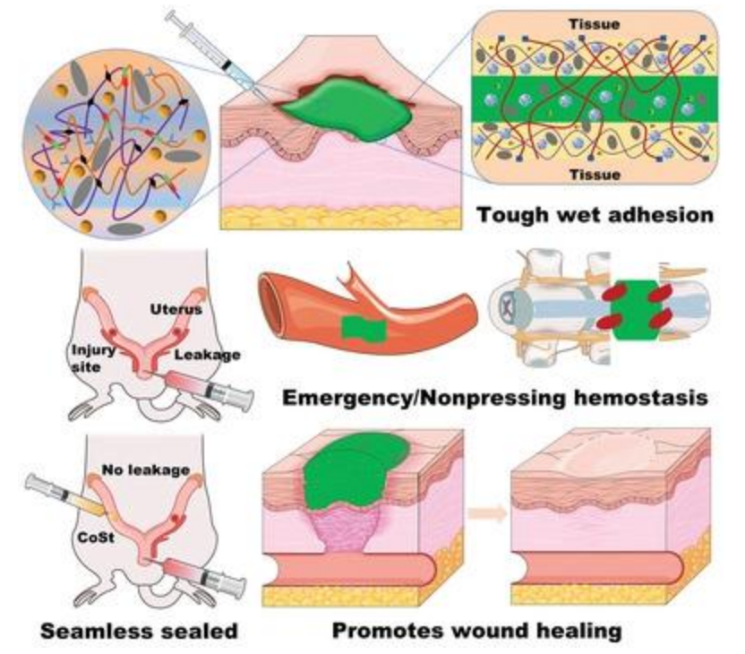 止血微球怎么用水凝胶微球应用集锦：水凝胶微球抗菌、抗炎、促伤口愈合（一）_https://www.jmylbn.com_新闻资讯_第10张
