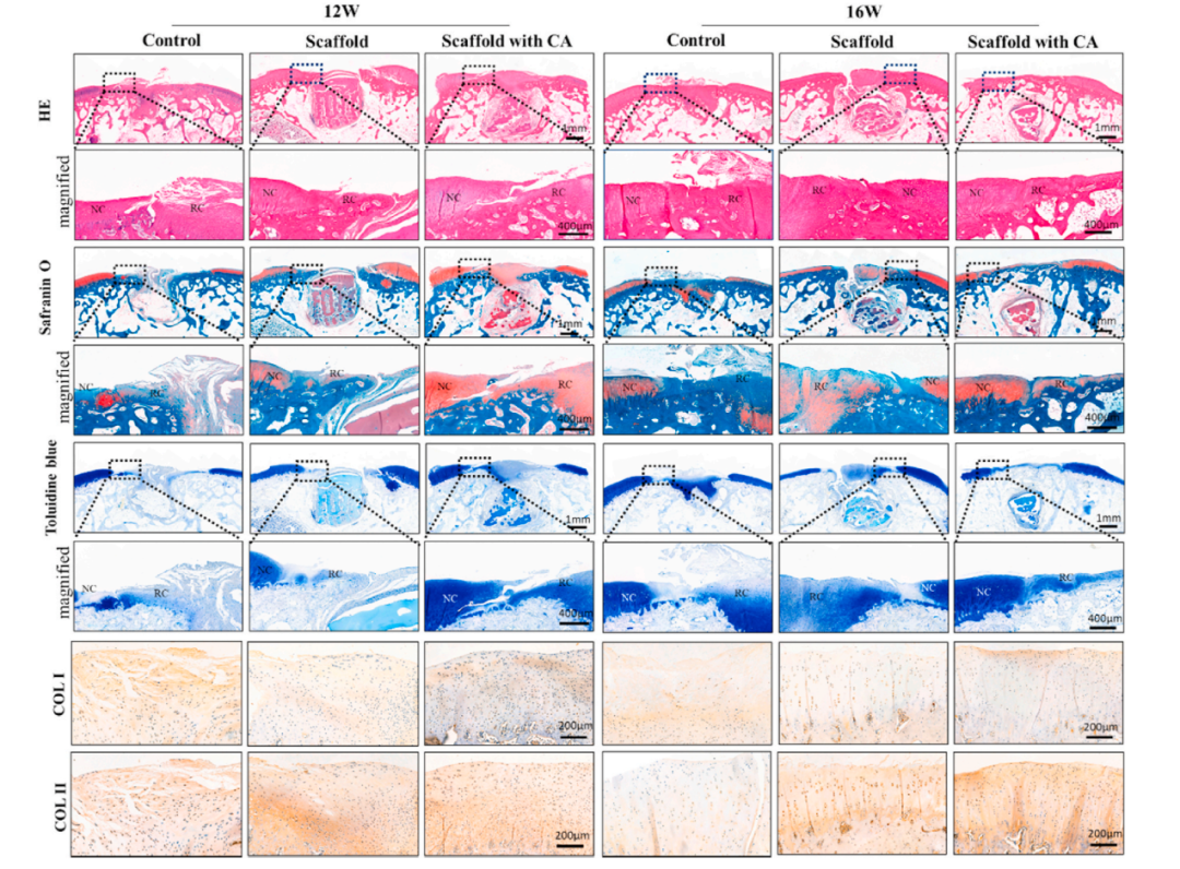 华南理工曹晓东团队：用于软骨再生的载干细胞3D打印丝素蛋白/明胶支架的图10