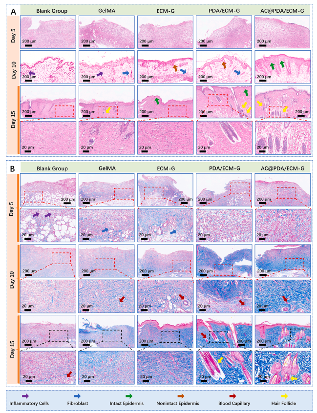 促愈凝胶怎么排出《Chemical Engineering Journal》：可用作可促进愈合的伤口敷料新型生物活性复合水凝胶_https://www.jmylbn.com_新闻资讯_第7张