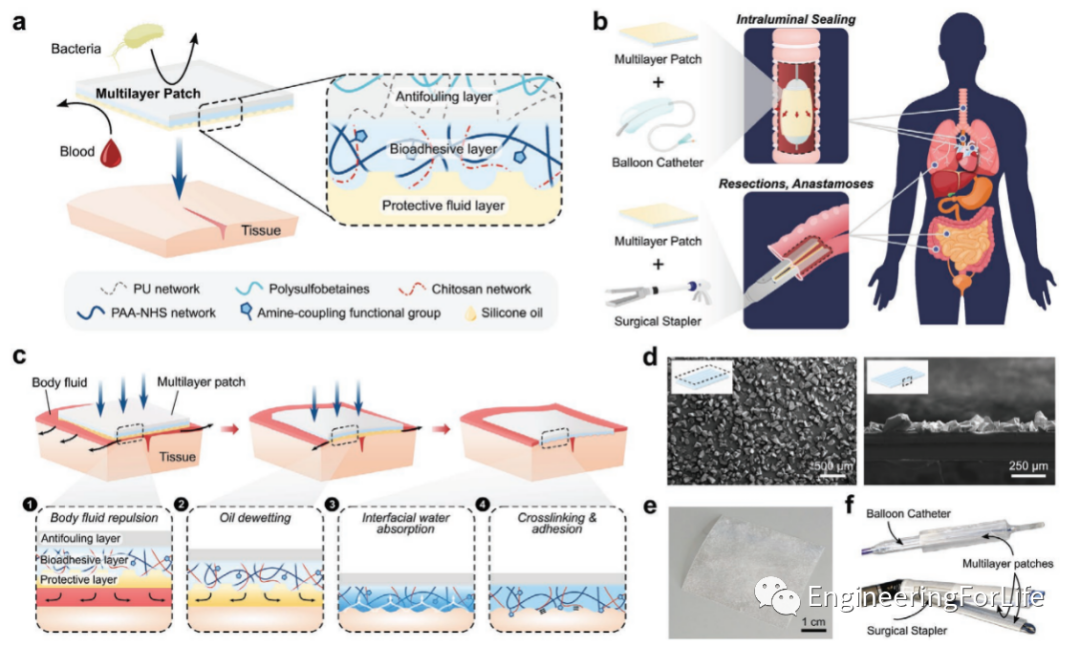 明胶在血管怎么降解【专题集锦】组织粘附与伤口敷料（20221002更新）_https://www.jmylbn.com_新闻资讯_第36张