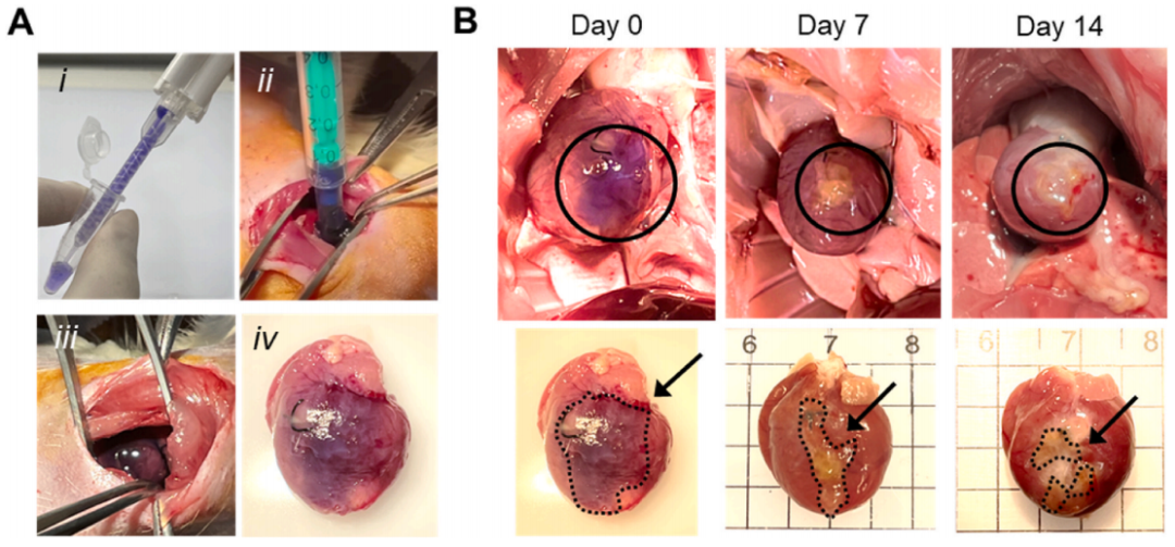 明胶在血管怎么降解《Bioactive Materials》：持续缓释抗炎蛋白的可涂黏附性水凝胶心脏贴片！用于心肌梗死的修复_https://www.jmylbn.com_新闻资讯_第7张