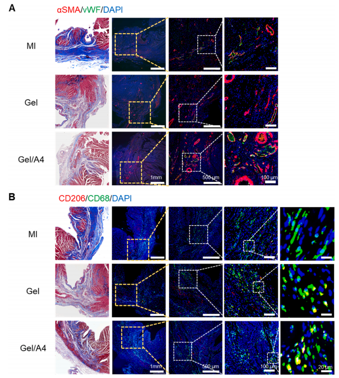 明胶在血管怎么降解《Bioactive Materials》：持续缓释抗炎蛋白的可涂黏附性水凝胶心脏贴片！用于心肌梗死的修复_https://www.jmylbn.com_新闻资讯_第9张