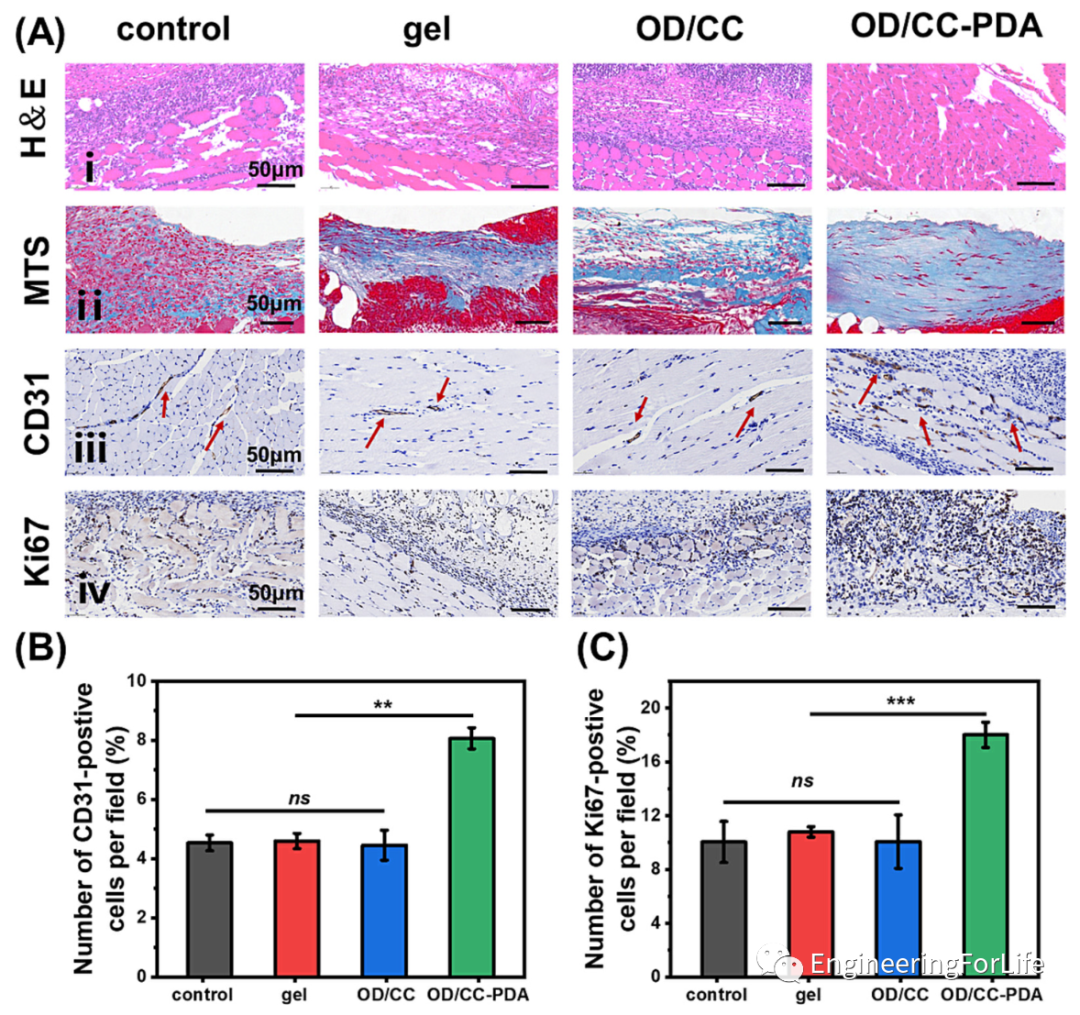 止血海绵怎么消毒《Carbohyd. Polym.》：多糖基海绵伤口敷料，快速止血&有效杀菌_https://www.jmylbn.com_新闻资讯_第7张