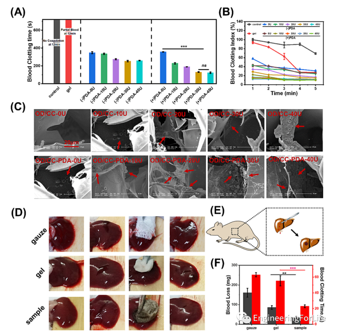 止血海绵怎么消毒《Carbohyd. Polym.》：多糖基海绵伤口敷料，快速止血&有效杀菌_https://www.jmylbn.com_新闻资讯_第5张