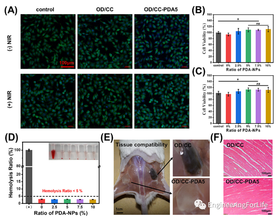 止血海绵怎么消毒《Carbohyd. Polym.》：多糖基海绵伤口敷料，快速止血&有效杀菌_https://www.jmylbn.com_新闻资讯_第4张