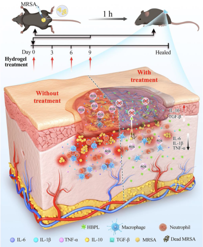 壳聚糖敷料什么时候用【专题集锦】用于细菌感染伤口愈合的创面敷料（12篇）_https://www.jmylbn.com_新闻资讯_第1张