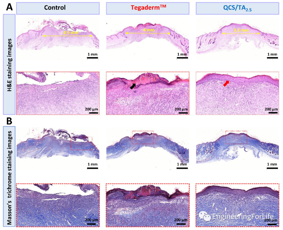 壳聚糖凝胶怎么用《ACS AMI》：巧用单宁酸，一步制备多功能壳聚糖水凝胶用于快速止血、皮肤伤口修复_https://www.jmylbn.com_新闻资讯_第12张