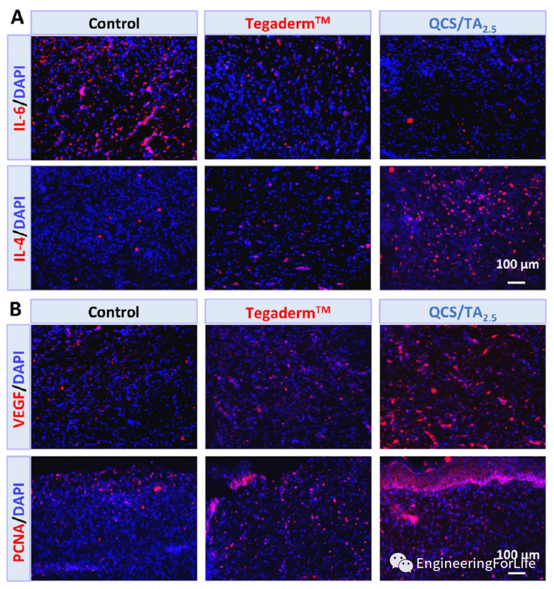 壳聚糖凝胶怎么用《ACS AMI》：巧用单宁酸，一步制备多功能壳聚糖水凝胶用于快速止血、皮肤伤口修复_https://www.jmylbn.com_新闻资讯_第13张