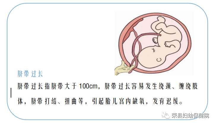 婴儿脐带连接母体图图片