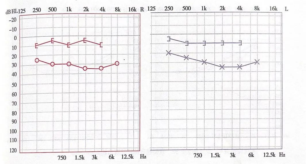 还不会看听力图?手把手来教你看!