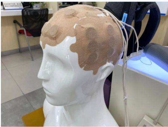 Optima什么医疗西格玛医学洞见：一文读懂肿瘤电场治疗及临床试验设计_https://www.jmylbn.com_新闻资讯_第3张