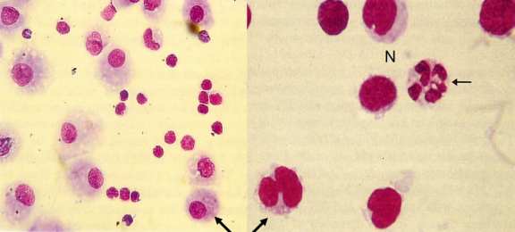 ero为什么不显示叶俏教授：HRCT是发现和鉴别「过敏性肺炎」的重要环节，何种表现指向预后不良？使患者发病的危害因素躲在哪些环境中？_https://www.jmylbn.com_新闻资讯_第58张