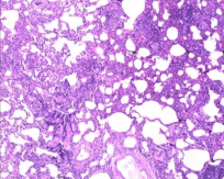 ero为什么不显示叶俏教授：HRCT是发现和鉴别「过敏性肺炎」的重要环节，何种表现指向预后不良？使患者发病的危害因素躲在哪些环境中？_https://www.jmylbn.com_新闻资讯_第20张