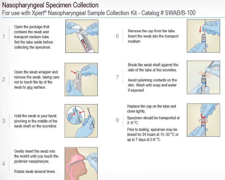 流感病毒怎么采样吴文娟主任：发热门诊呼吸道病原体快速筛查丨解密流感（3）_https://www.jmylbn.com_新闻资讯_第9张