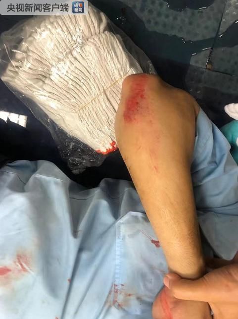“这已是恐怖主义！”除了投汽油弹，乱港暴徒还用“枪”袭警！（视频/组图） - 3