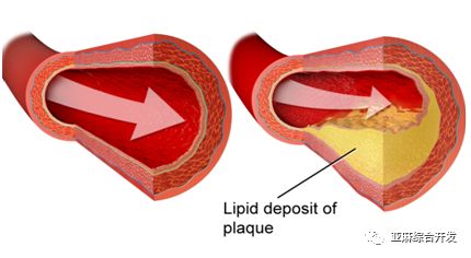 亚麻籽油是最佳食用油