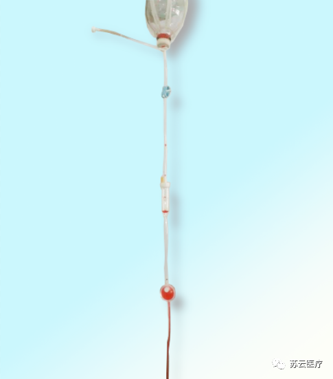 一次性输液器怎么用【产品介绍】一次性使用排气式输液器 带针_https://www.jmylbn.com_新闻资讯_第4张