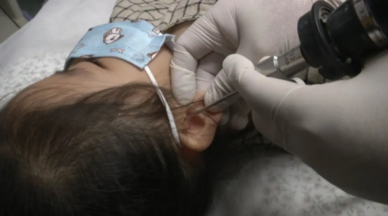 耳镜怎么做怀疑小孩中耳炎？这些检查都要做！_https://www.jmylbn.com_新闻资讯_第4张