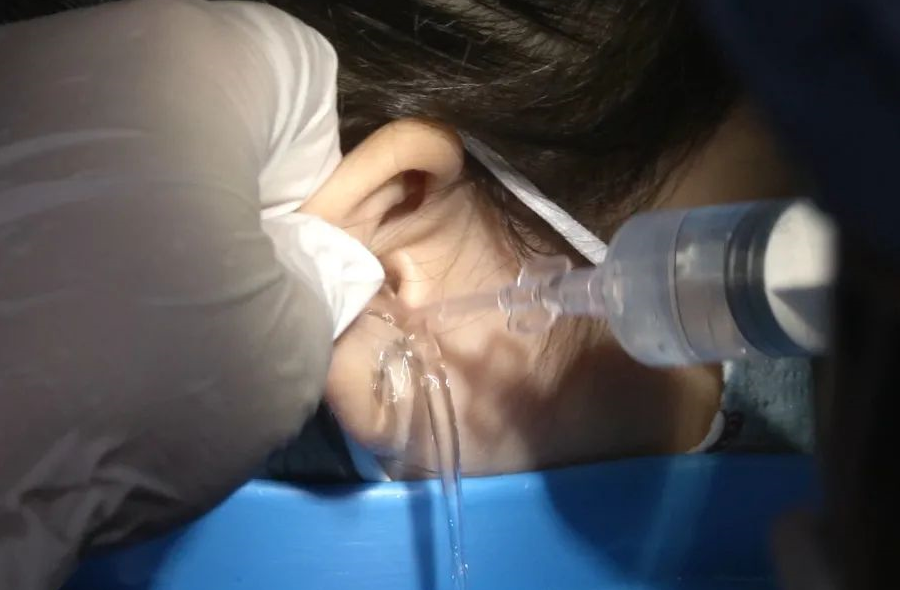 耳镜怎么做怀疑小孩中耳炎？这些检查都要做！_https://www.jmylbn.com_新闻资讯_第5张