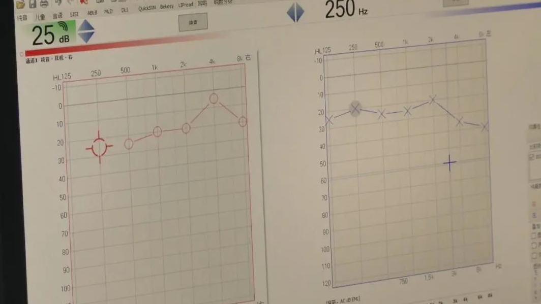 耳镜怎么做怀疑小孩中耳炎？这些检查都要做！_https://www.jmylbn.com_新闻资讯_第12张