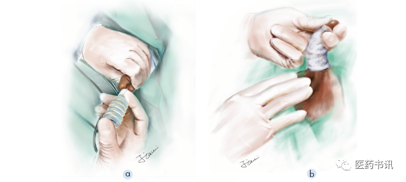 膀胱镜检查需要哪些器械当医学遇上美术｜膀胱镜检查准备_https://www.jmylbn.com_新闻资讯_第10张