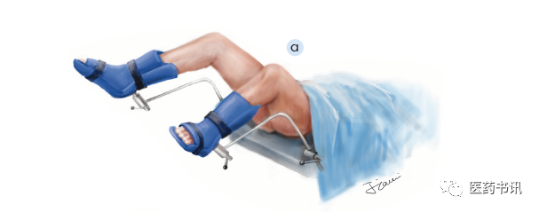 膀胱镜检查需要哪些器械当医学遇上美术｜膀胱镜检查准备_https://www.jmylbn.com_新闻资讯_第2张