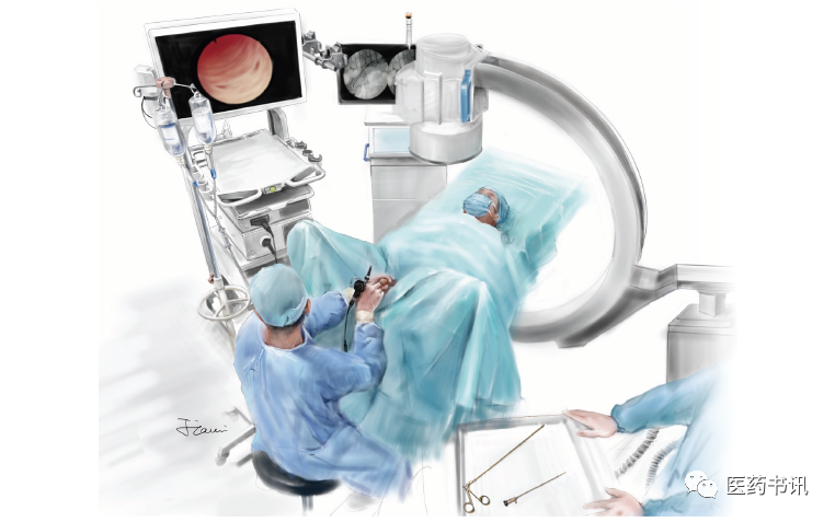 膀胱镜检查需要哪些器械当医学遇上美术｜膀胱镜检查准备_https://www.jmylbn.com_新闻资讯_第7张