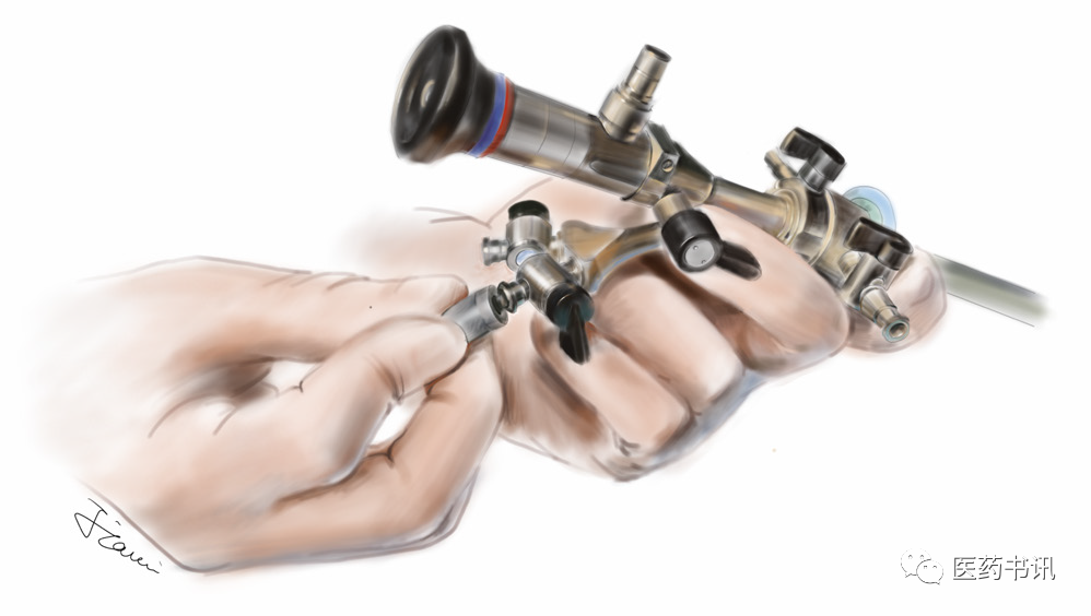 膀胱器械都有哪些图片当医学遇上美术｜硬性膀胱镜_https://www.jmylbn.com_新闻资讯_第11张