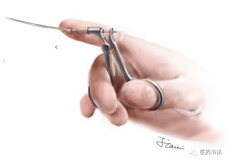 膀胱器械都有哪些图片当医学遇上美术｜硬性膀胱镜_https://www.jmylbn.com_新闻资讯_第10张