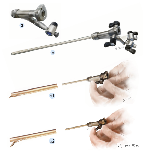 膀胱器械都有哪些图片当医学遇上美术｜硬性膀胱镜_https://www.jmylbn.com_新闻资讯_第7张