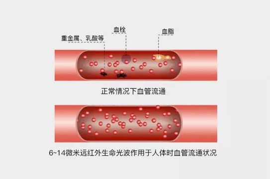 石墨烯PK碳纤维发热丝,谁更胜一筹？
