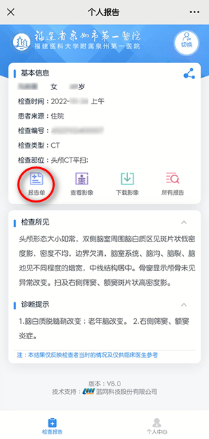 怎么自助取胶片医院【智慧就医】手机扫一扫，取片不用跑--“云胶片”上线啦！_https://www.jmylbn.com_新闻资讯_第7张