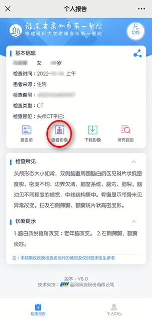 怎么自助取胶片医院【智慧就医】手机扫一扫，取片不用跑--“云胶片”上线啦！_https://www.jmylbn.com_新闻资讯_第9张