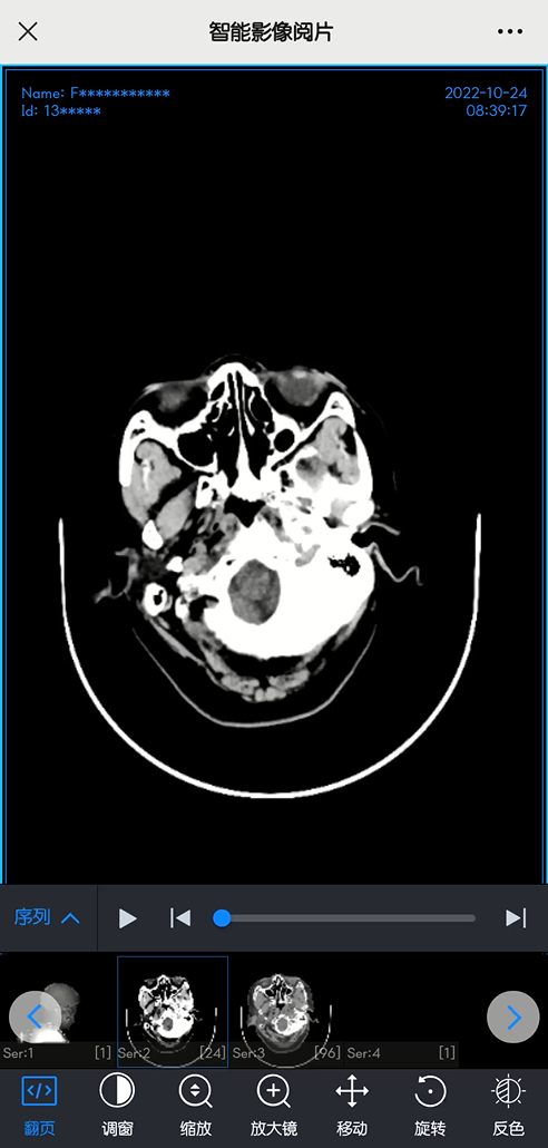 怎么自助取胶片医院【智慧就医】手机扫一扫，取片不用跑--“云胶片”上线啦！_https://www.jmylbn.com_新闻资讯_第10张