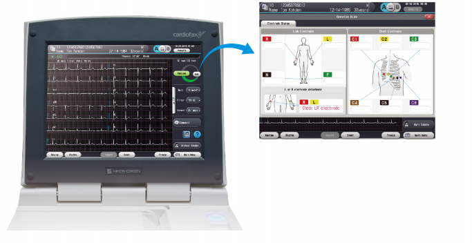 日本心电图怎么用营口市中西医结合医院最新引进日本光电次世代高端心电图机ECG-2450_https://www.jmylbn.com_新闻资讯_第19张