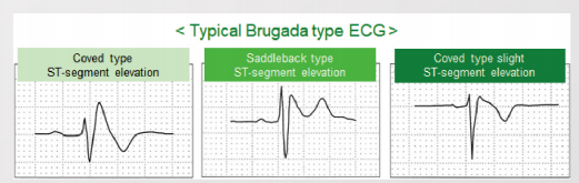 日本心电图怎么用营口市中西医结合医院最新引进日本光电次世代高端心电图机ECG-2450_https://www.jmylbn.com_新闻资讯_第21张