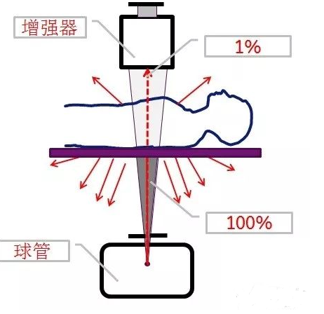 c臂机怎么开机手术室C臂机的辐射防护_https://www.jmylbn.com_新闻资讯_第5张